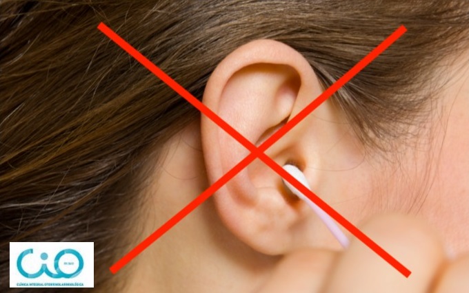 Inferior empezar masculino Cómo quitar los tapones de cera de los oídos - CIO Salud