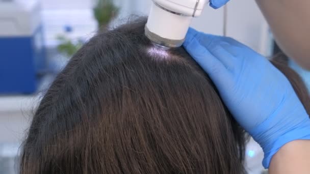 tratamiento alopecia