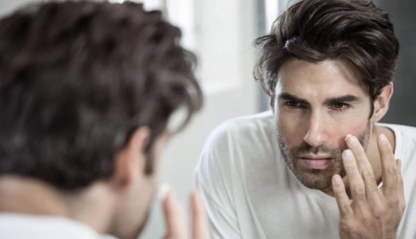 dermatitis seborreica