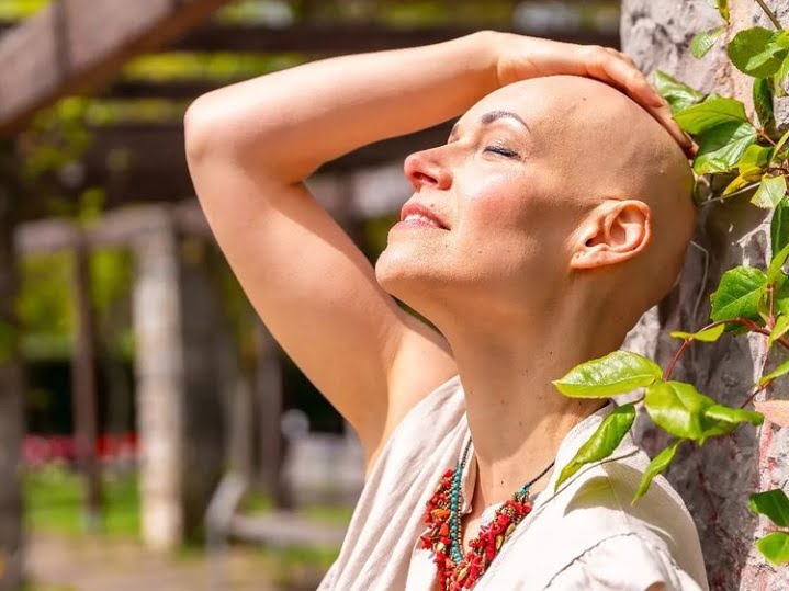 Tratamiento Alopecia Areata Universal