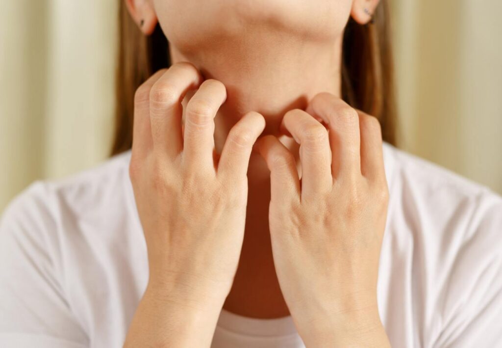 piel sensible dermatología