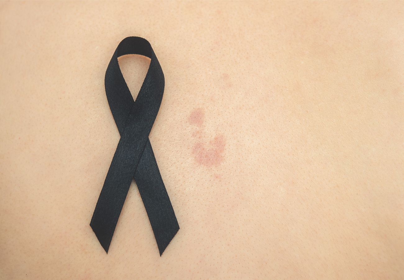 DÍA MUNDIAL CONTRA EL CÁNCER DE PIEL