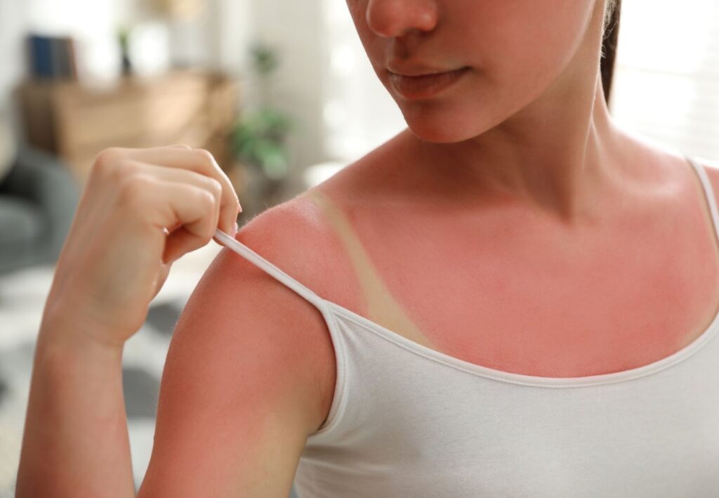 protección solar segura