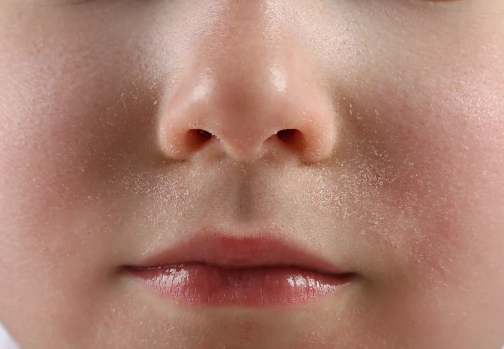 Consejos para proteger la piel en invierno - CIO Salud