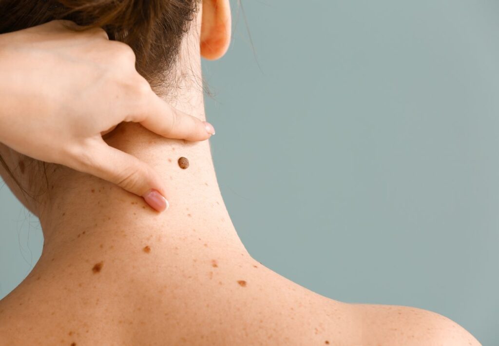 diferencias dermatología y venereología