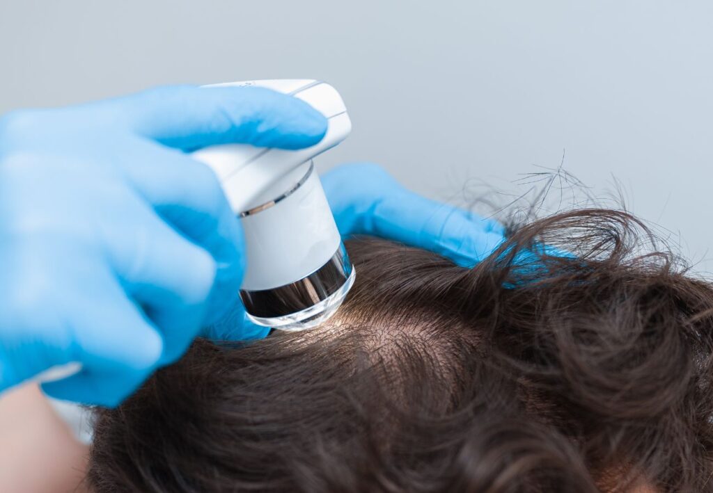 dermatólogo capilar