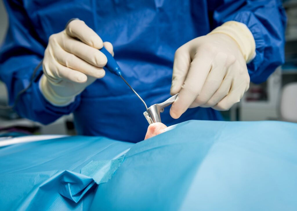 cirugía nasal correctiva