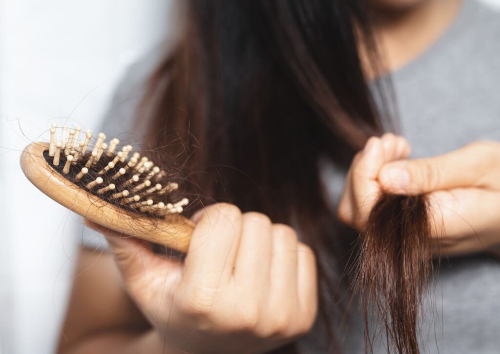 tratamientos anticaída