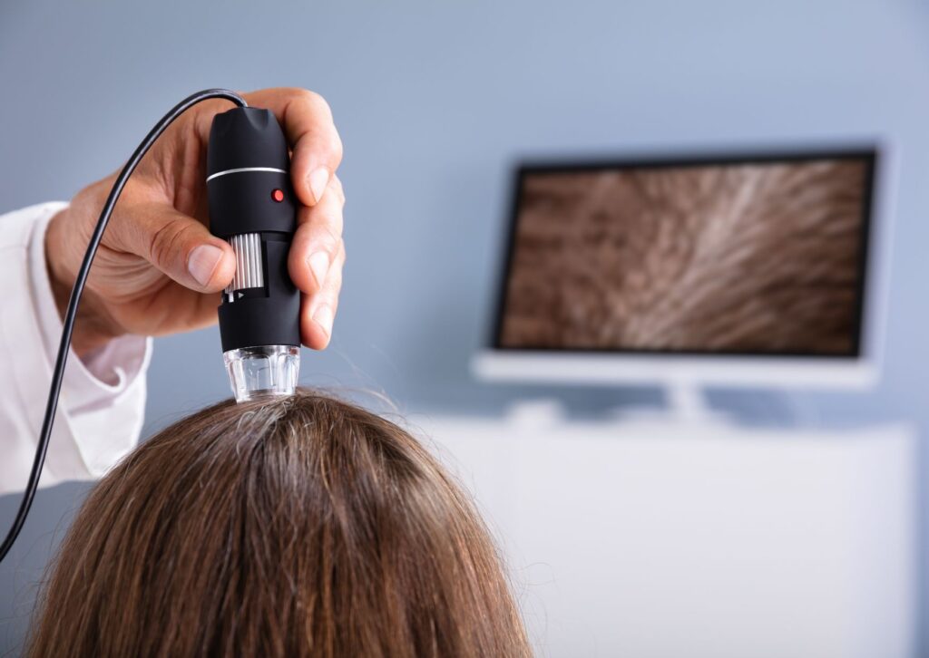 dermatólogo capilar Bilbao