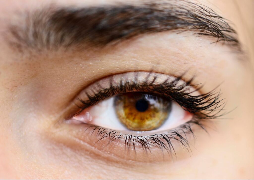 calvicie en cejas