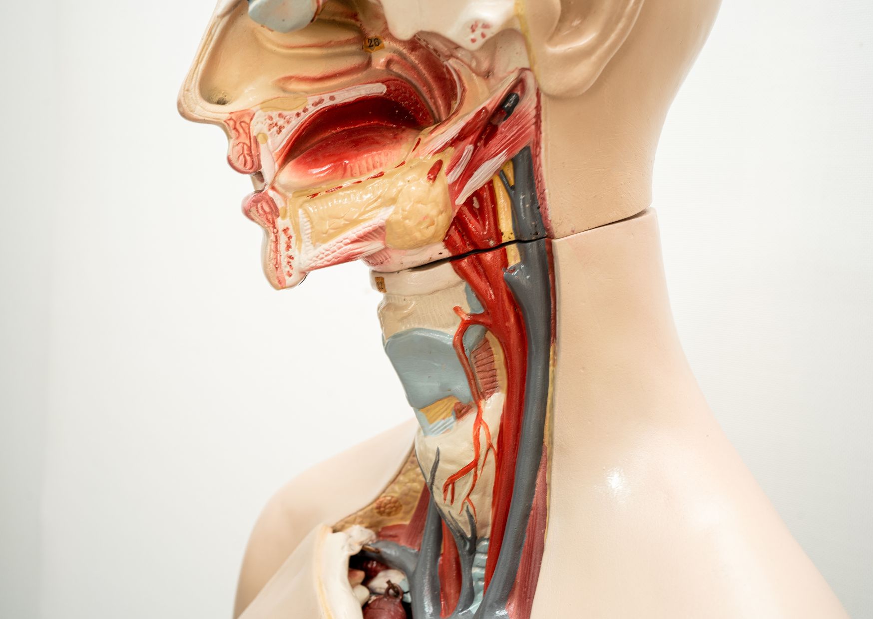 laringectomía parcial