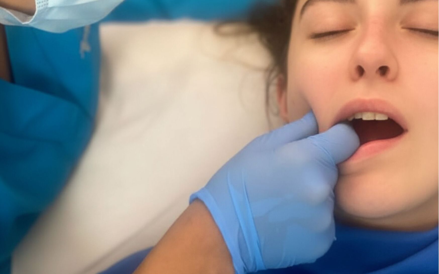 bloqueo mandibular
